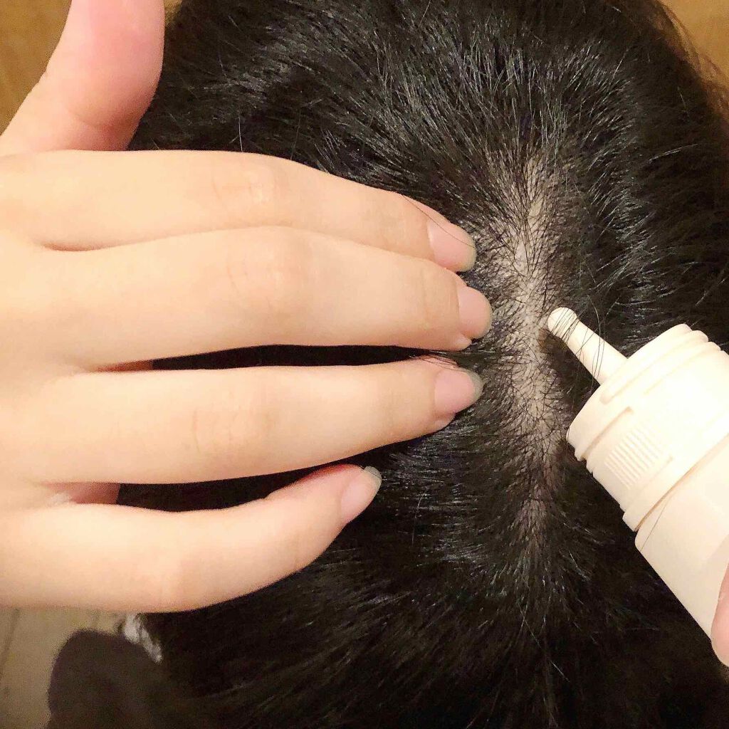 マイナチュレ 無添加育毛剤/マイナチュレ/頭皮ローションを使ったクチコミ(3枚目)