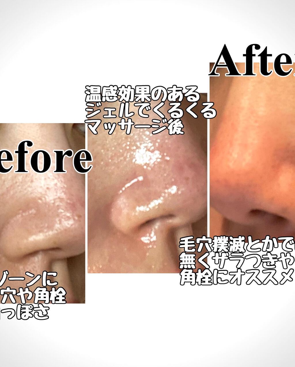 ポアゼロクリアジェル/BRTC/ピーリングを使ったクチコミ（3枚目）