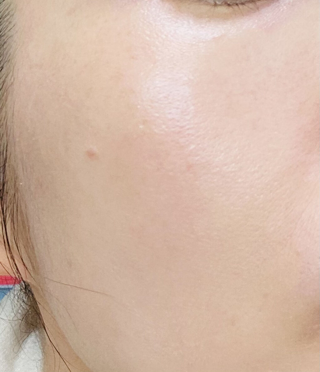 DHC ビタミンＣハードカプセル/DHC/美容サプリメントを使ったクチコミ（2枚目）