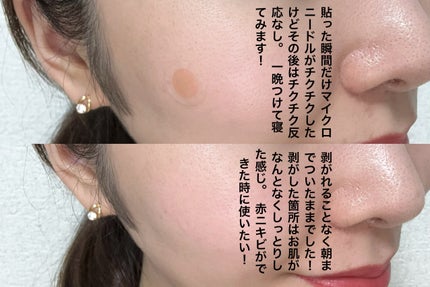 スポットイレイザー/NOLAHOUR/その他スキンケアを使ったクチコミ(4枚目)