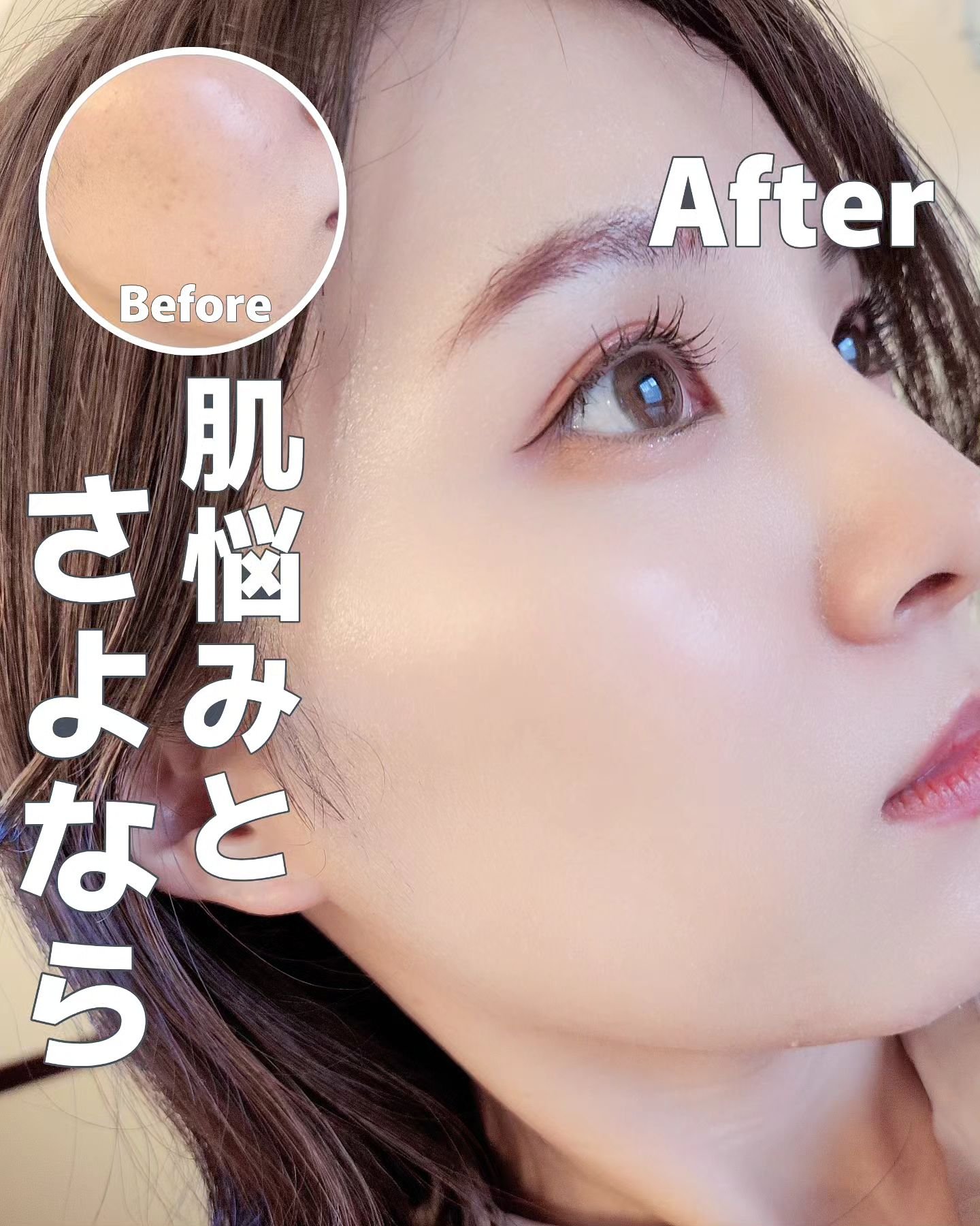 ロングラスティングチップコンシーラー/LUNA/リキッドコンシーラーを使ったクチコミ（1枚目）