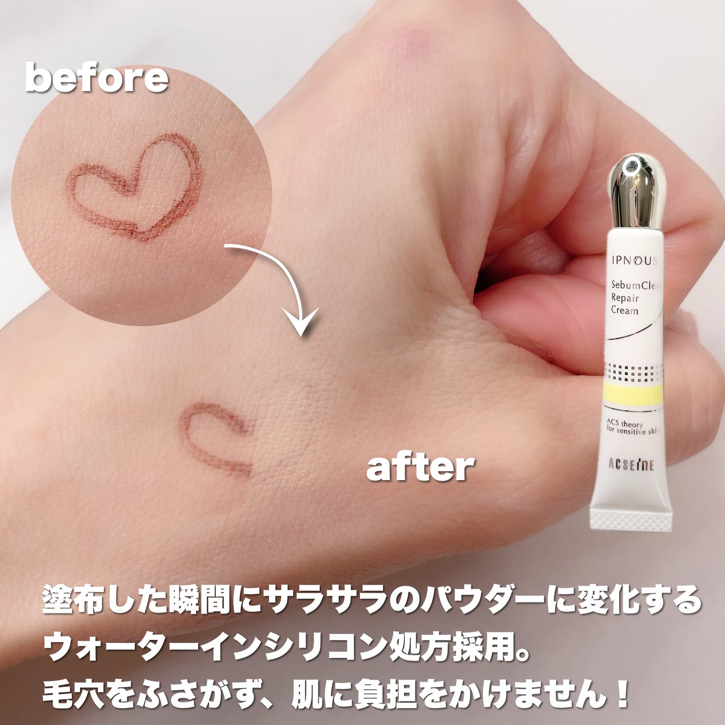 イプノス シーバムクリア リペアクリーム/ACSEINE/フェイスクリームを使ったクチコミ(4枚目)