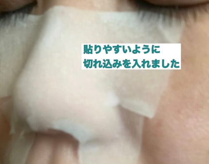 CICA ブラックヘッドクリーナー/VT/その他スキンケアを使ったクチコミ(6枚目)