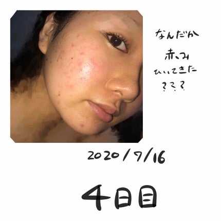 を使ったクチコミ(2枚目)