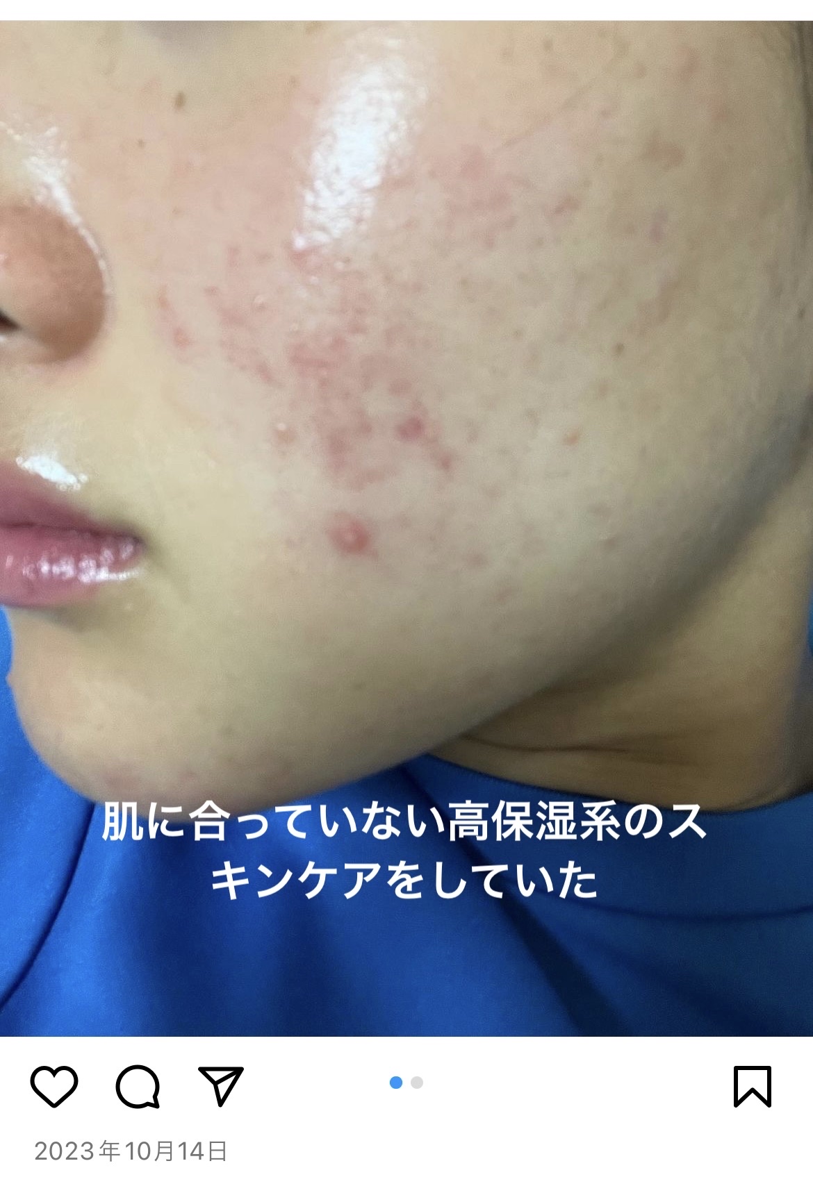 発酵導入化粧液/無印良品/化粧水を使ったクチコミ（2枚目）