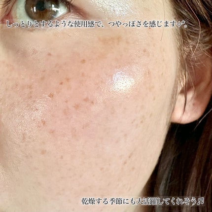 ターンオーバーアンプル/REJURAN COSMETICS/美容液を使ったクチコミ(6枚目)