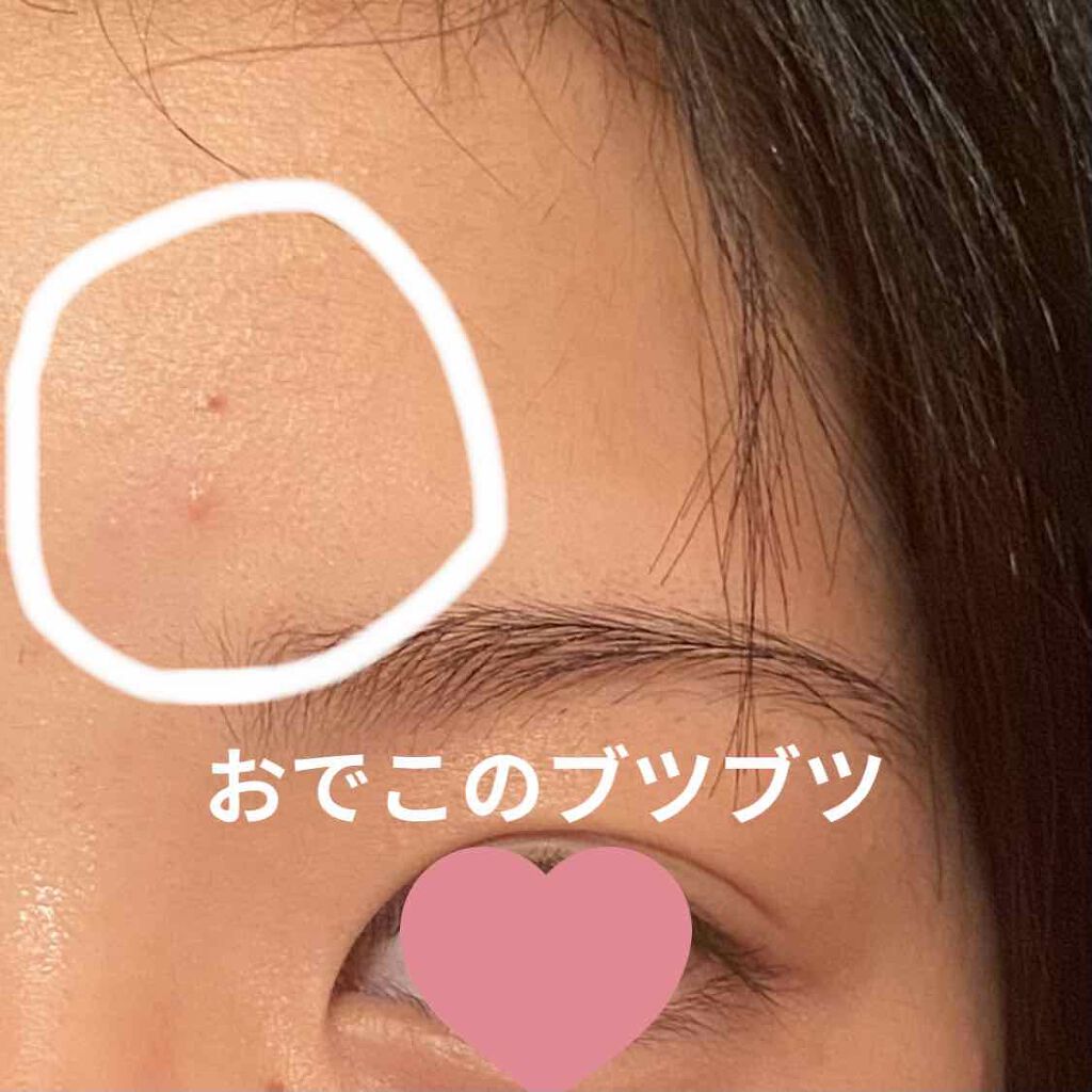 芋子 on LIPS 「誰か助けてください!あまり写真では見えにくいのですが、鼻の毛穴..」(1枚目)