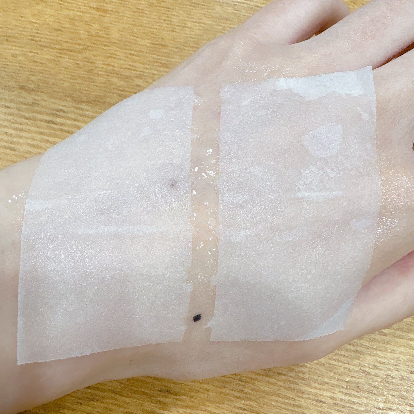 TECA COOLING PAD /LEADERS/トナーパッドを使ったクチコミ(6枚目)