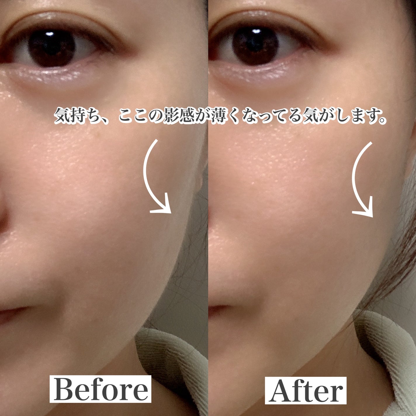 ステラボーテ レーザー & EMSリフトブラシPRO|STELLA BEAUTEの ステラボーテ レーザー & EMSリフトブラシPRO|STELLA BEAUTEの