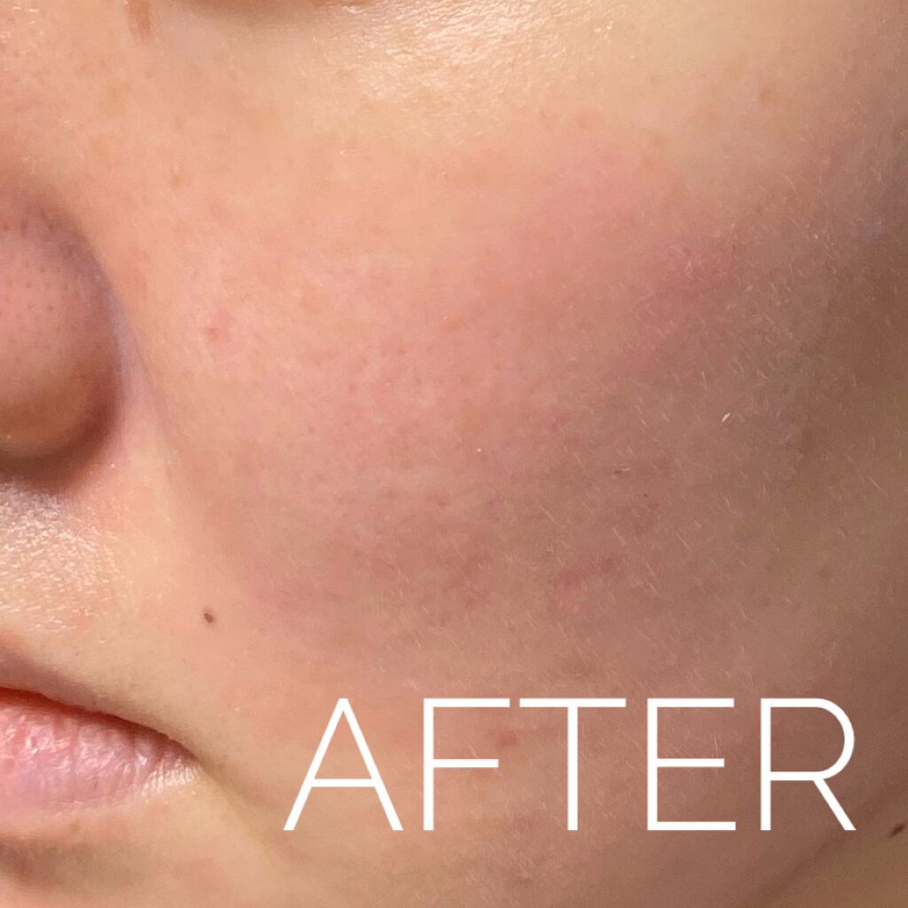 エクサージュホワイト ホワイトライズ ミルク/ALBION/乳液を使ったクチコミ(3枚目)