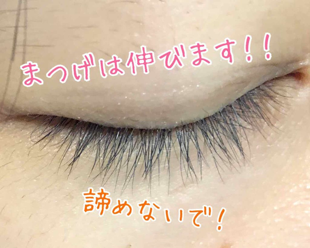 ローヤルゼリー配合 栄養ローション/DAISO/美容液を使ったクチコミ(1枚目)