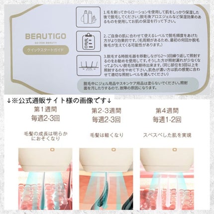 サファイアIPL脱毛器 /yete/家庭用脱毛器を使ったクチコミ(3枚目)