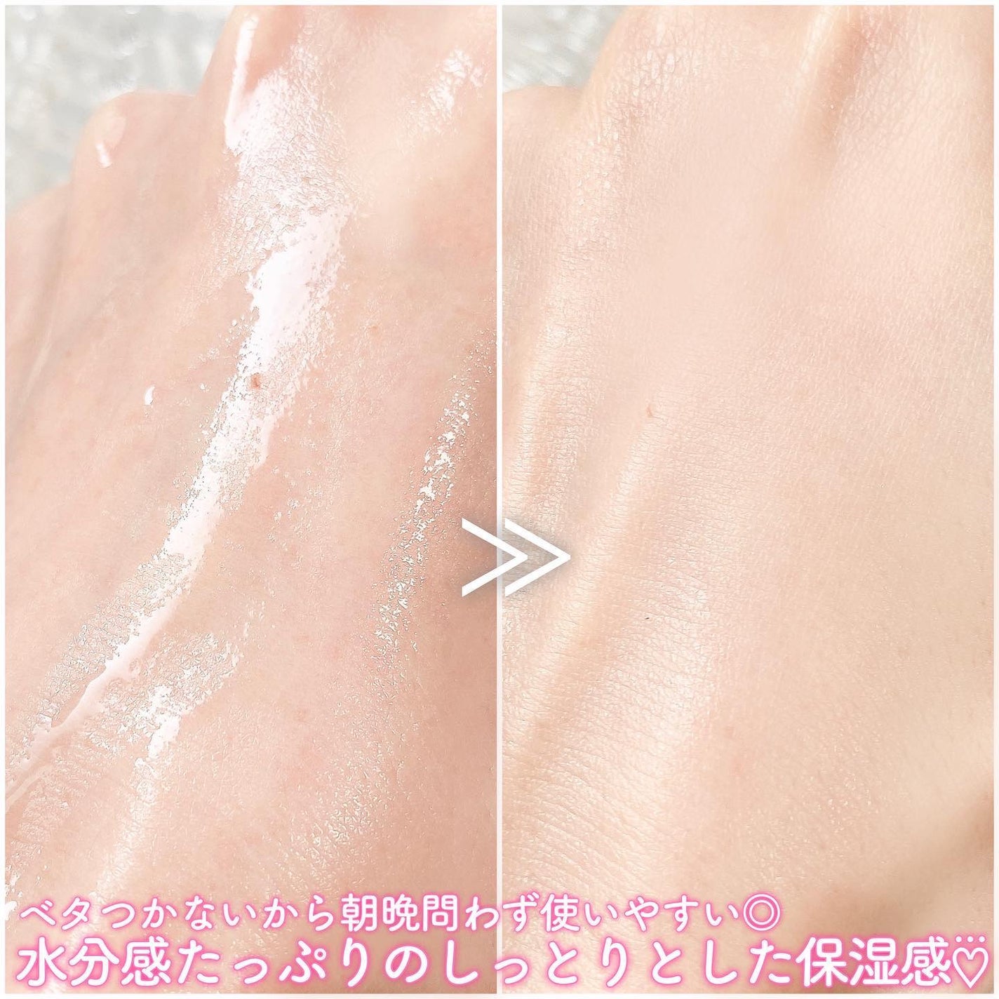 レッドブレミッシュ クリアスージングトナー/Dr.G/化粧水を使ったクチコミ(4枚目)