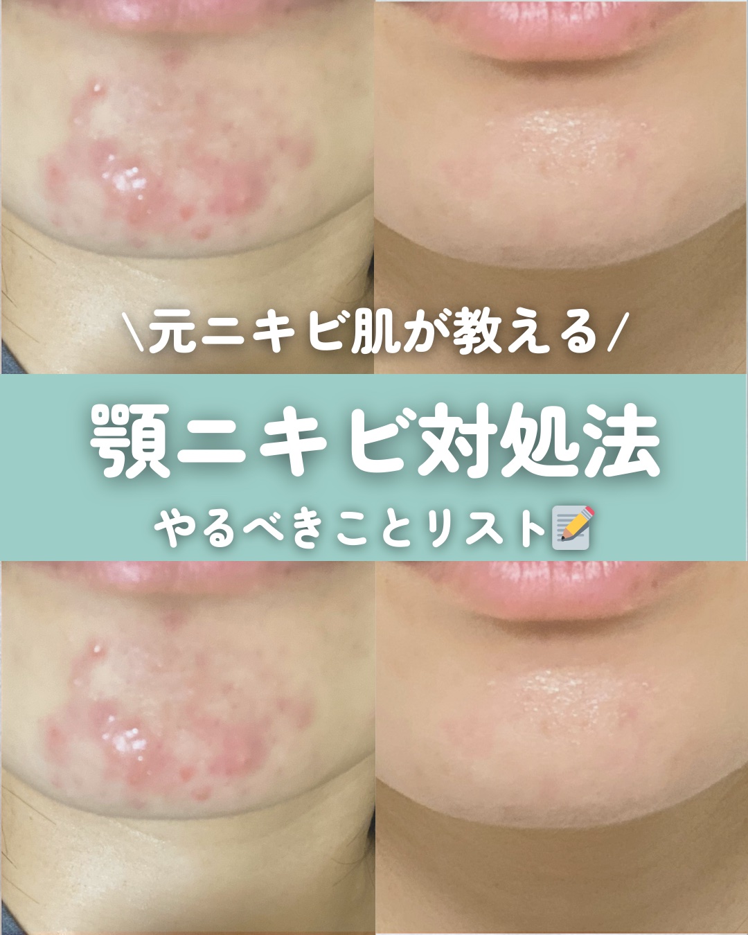 ディープモイスチャースプレー/キュレル/ミスト状化粧水を使ったクチコミ（1枚目）