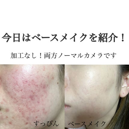 ディオールスキン フォーエヴァー アンダーカバー/Dior/リキッドファンデーションを使ったクチコミ(1枚目)