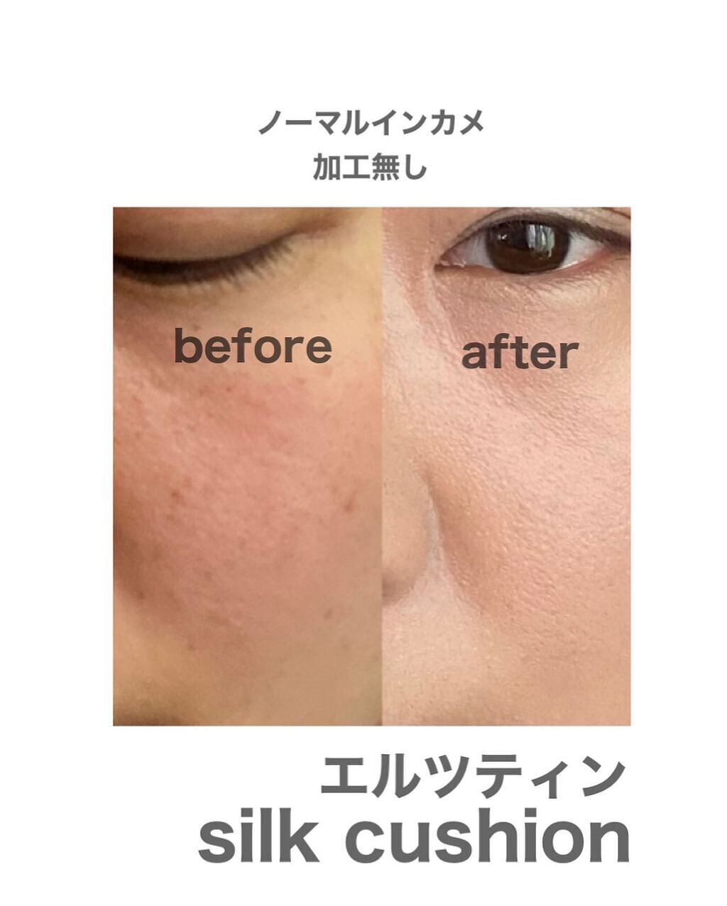 sui on LIPS 「\スキンケアしながら陶器肌🧡/今日は神奈川は雨☔️気分が上がら..」(5枚目)