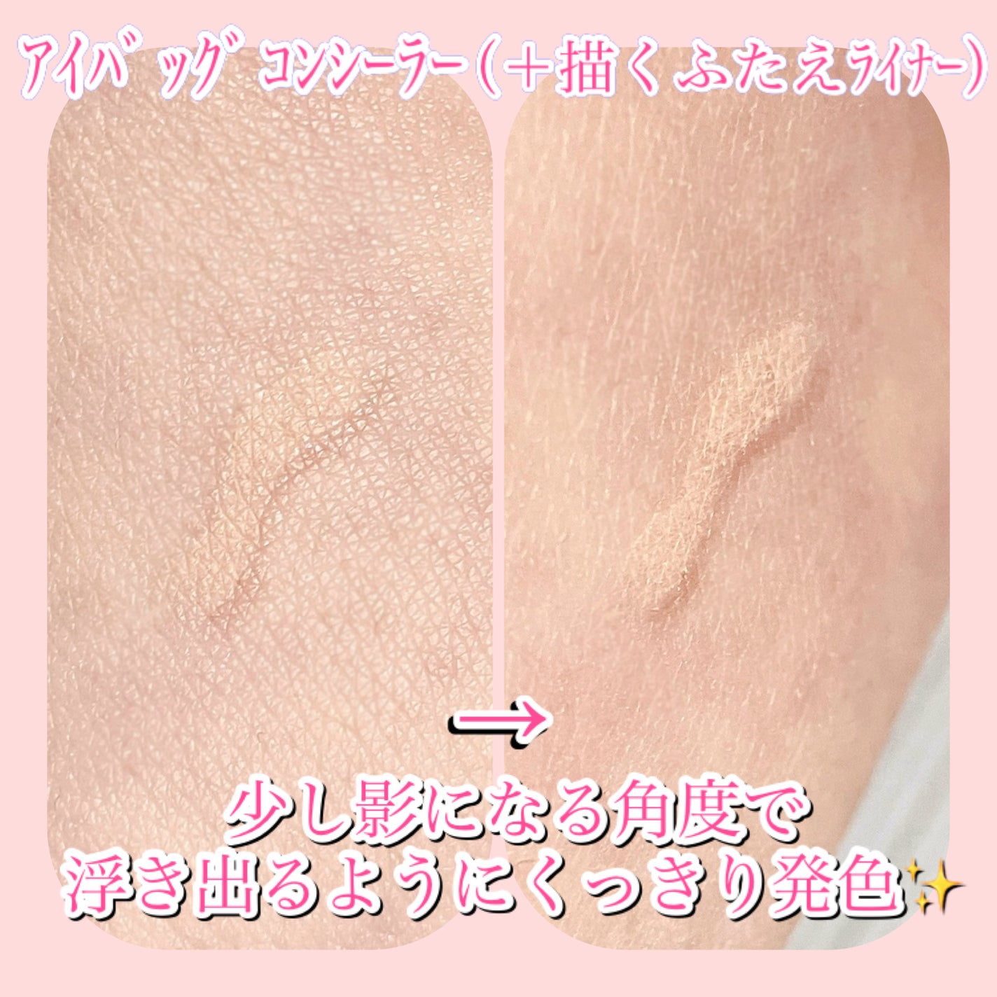 アイバッグコンシーラー/キャンメイク/ペンシルコンシーラーを使ったクチコミ(2枚目)