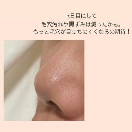 ダヴ 吸着毛穴ケア 洗顔ジェル/ダヴ/その他洗顔料を使ったクチコミ(3枚目)