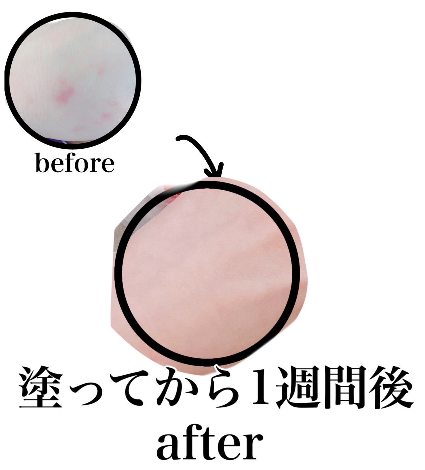 もか@フォロバ100 on LIPS 「手荒れがひどくて塗ったらとってもよくなったこちらを紹介!それは..」(1枚目)