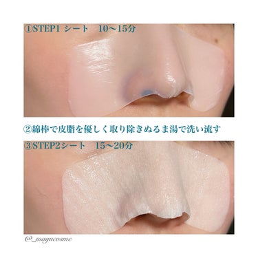 ilso ナチュラルマイルドクリアノーズパックのクチコミ「皮脂汚れを溶かして除去！鼻パック👃🏻
ーーーーーーーーーーーーーーーーーーーーーー
ilso
.....」（3枚目）