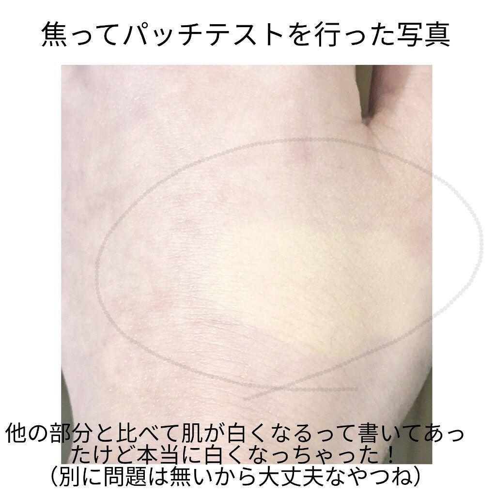 脱色クリーム スピーディー/エピラット/ムダ毛ケアを使ったクチコミ(2枚目)