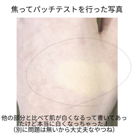 脱色クリーム スピーディー/エピラット/ムダ毛ケアを使ったクチコミ(2枚目)