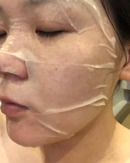 シカアルブチンマスク/NOWATER/シートマスク・パックを使ったクチコミ(4枚目)