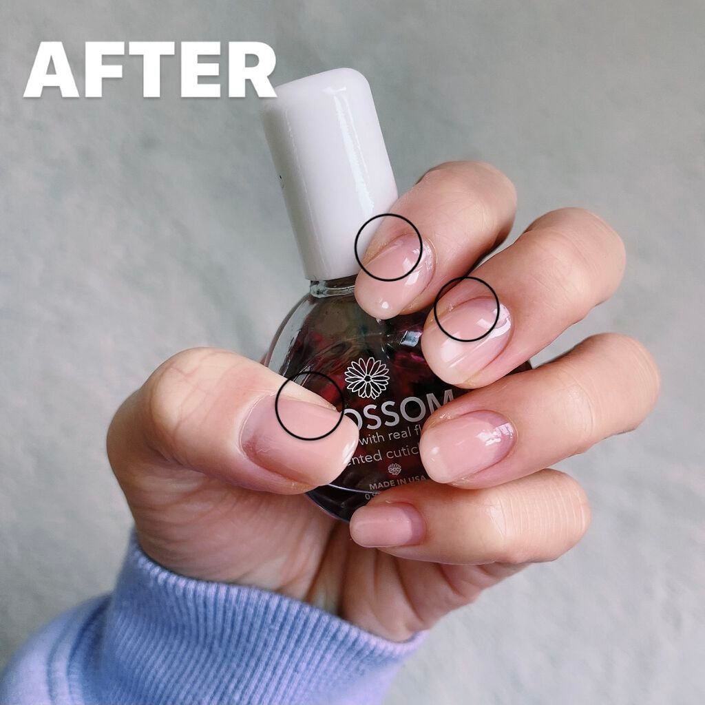 キューティクルオイル/キャンディ ブロッサム/ネイルオイル・トリートメントを使ったクチコミ(4枚目)