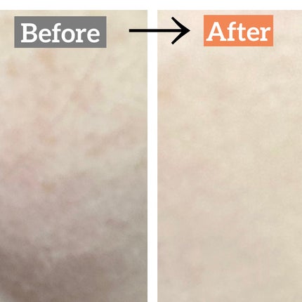 ルルルンピュア 青 (モイスト)/ルルルン/シートマスク・パックを使ったクチコミ(3枚目)