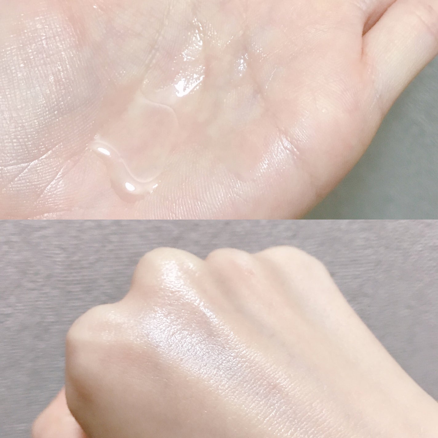 DETクリア ブライト&ピール ピール美容液/Detclear/美容液を使ったクチコミ(2枚目)