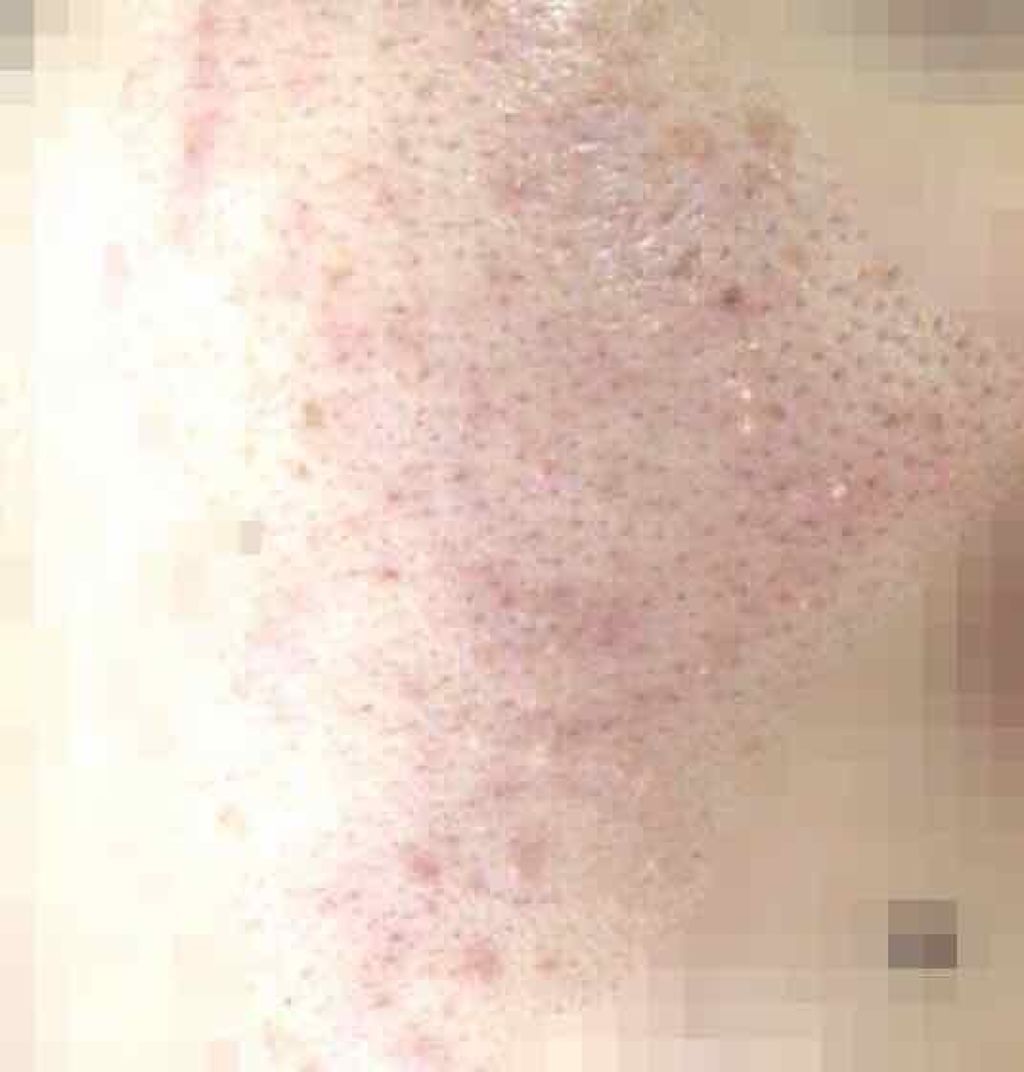 ハトムギ化粧水(ナチュリエ スキンコンディショナー R )/ナチュリエ/化粧水を使ったクチコミ（2枚目）