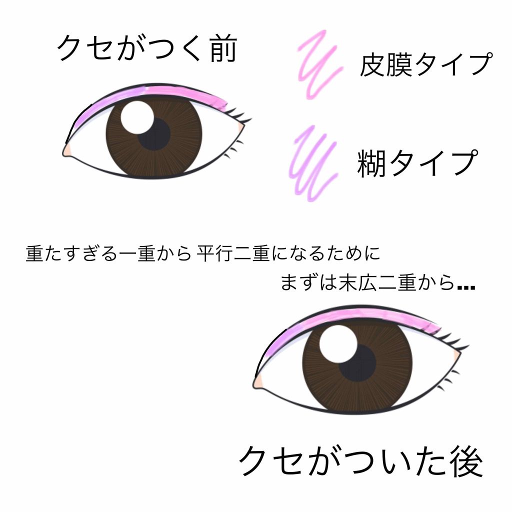 パワーアイリッドフィックス/Decorative Eyes/二重まぶた用アイテムを使ったクチコミ（2枚目）