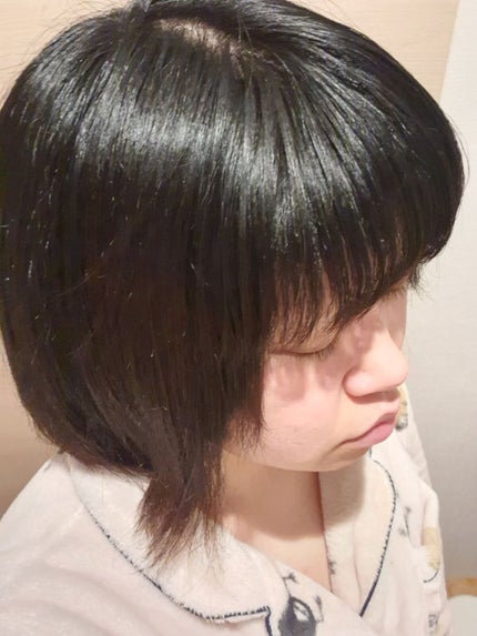 グリセリンP「ケンエー」/健栄製薬/その他を使ったクチコミ(4枚目)