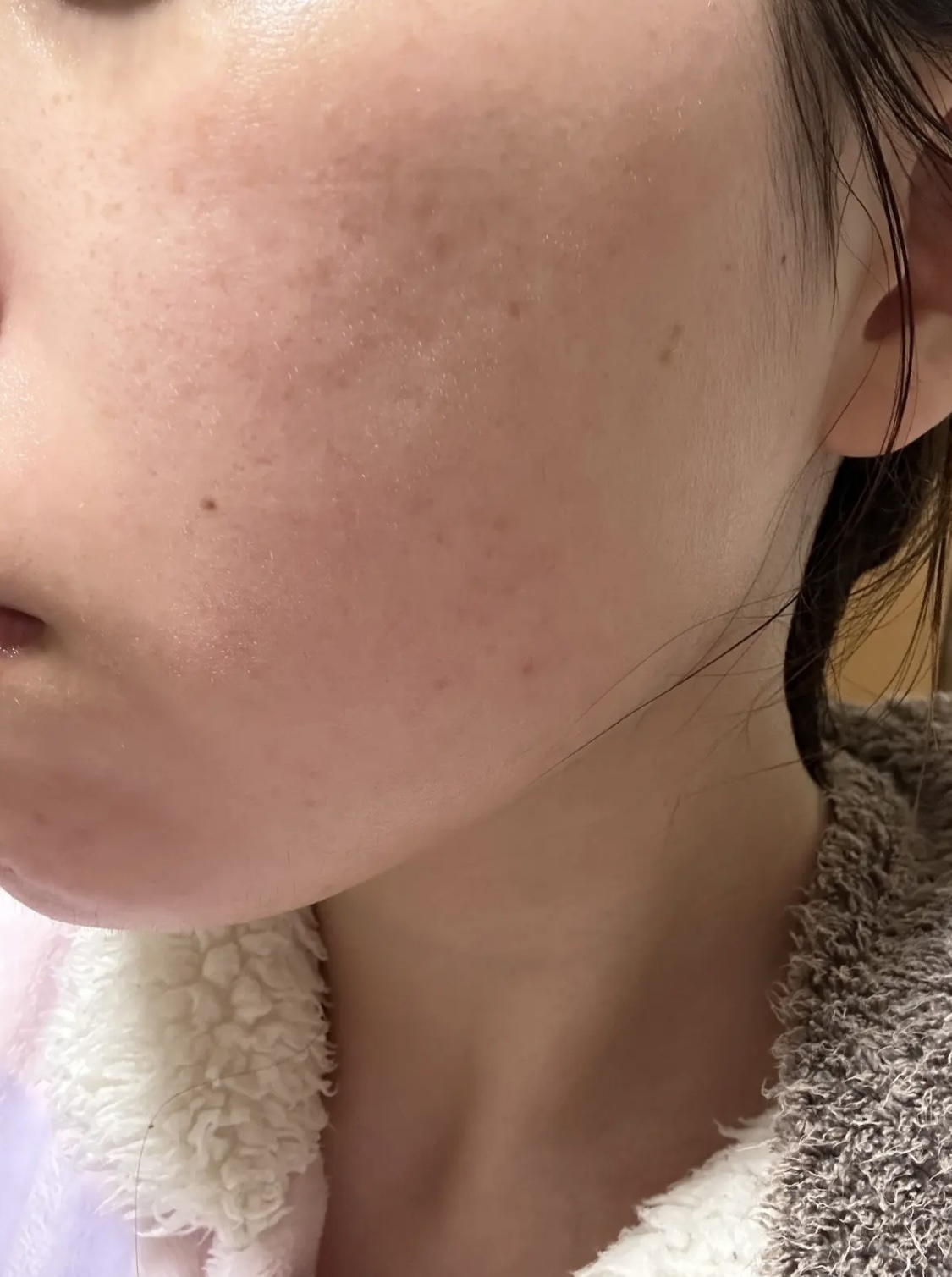 LA10+HAフェイスセラム/The Ordinary/ピーリングを使ったクチコミ（3枚目）