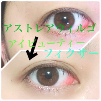 アイビューティー フィクサー WP/アストレア ヴィルゴ/二重まぶた用アイテムを使ったクチコミ(1枚目)
