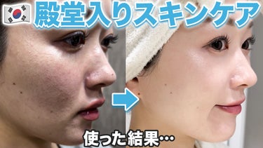 It's skin パワー10フォーミュラLIゼリーパッドカンゾウズレン のクチコミ「メガ割購入の前に要チェック‼️
韓国女子に人気の化粧品ランキングサイト
ファへの肌質、年齢.....」（1枚目）