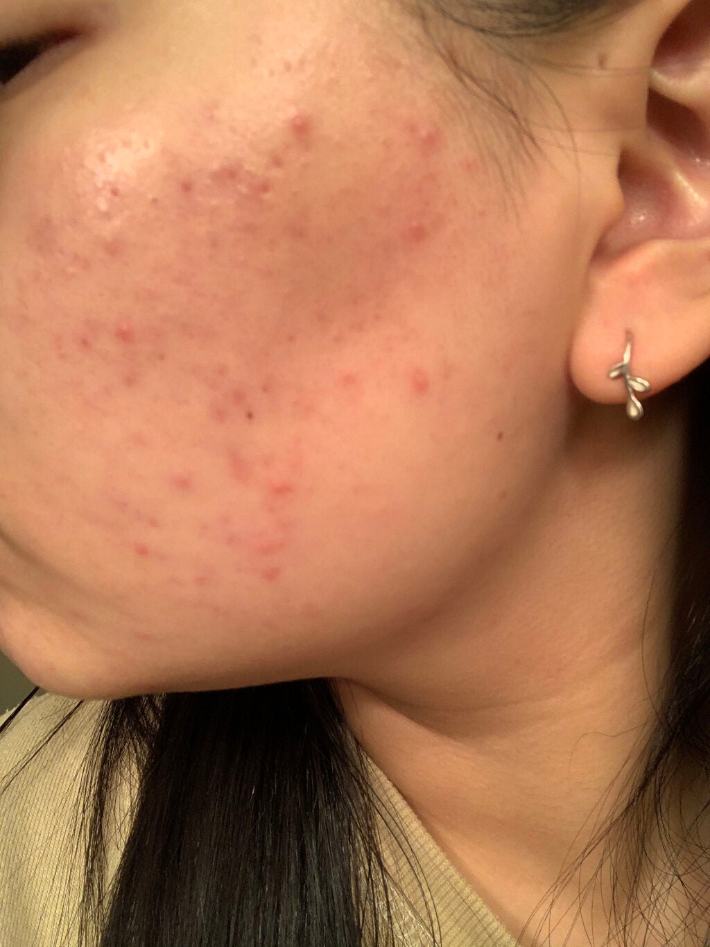 ティーツリーケア ソリューション エッセンシャルマスクEX/MEDIHEAL/シートマスク・パックを使ったクチコミ(3枚目)