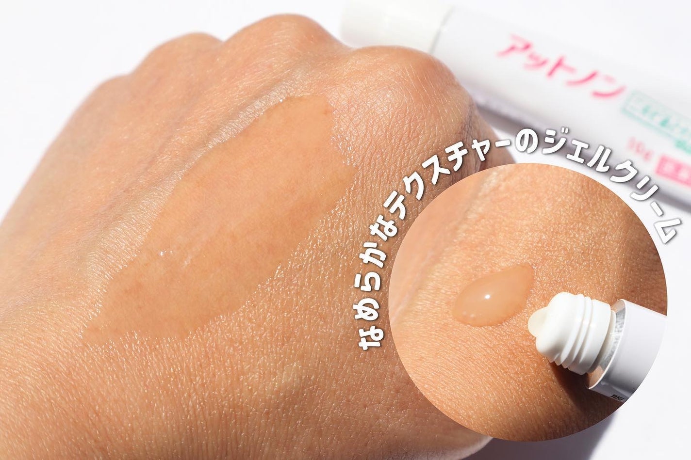 ニキビあとケアジェル/アットノン/その他スキンケアを使ったクチコミ(2枚目)