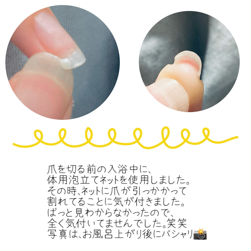 爪切り/DAISO/ネイルオイル・トリートメントを使ったクチコミ（2枚目）