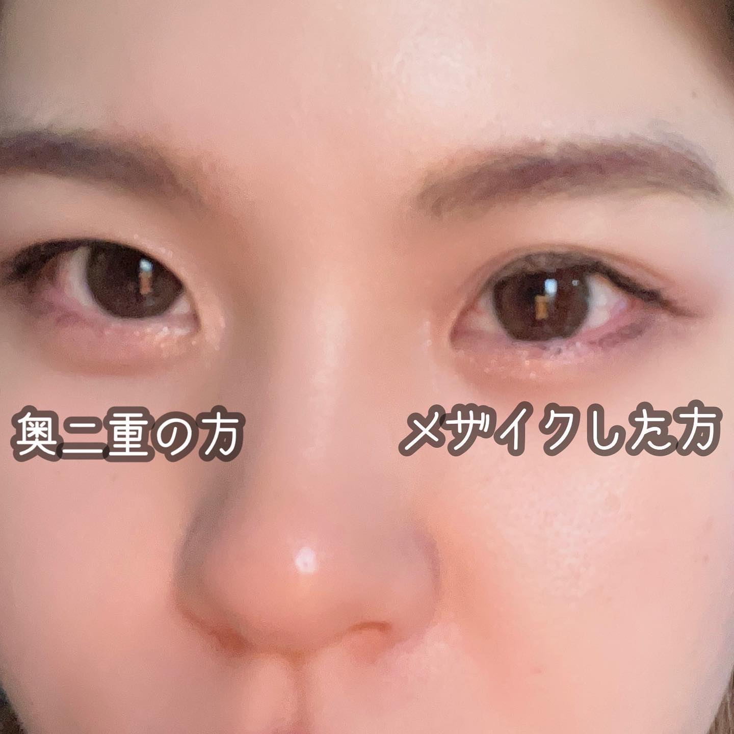 メザイク イージークリア 接着クリアタイプ/メザイク/二重まぶた用アイテムを使ったクチコミ（2枚目）