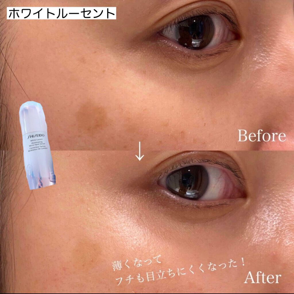 メラノフォーカスV/HAKU/美容液を使ったクチコミ(3枚目)