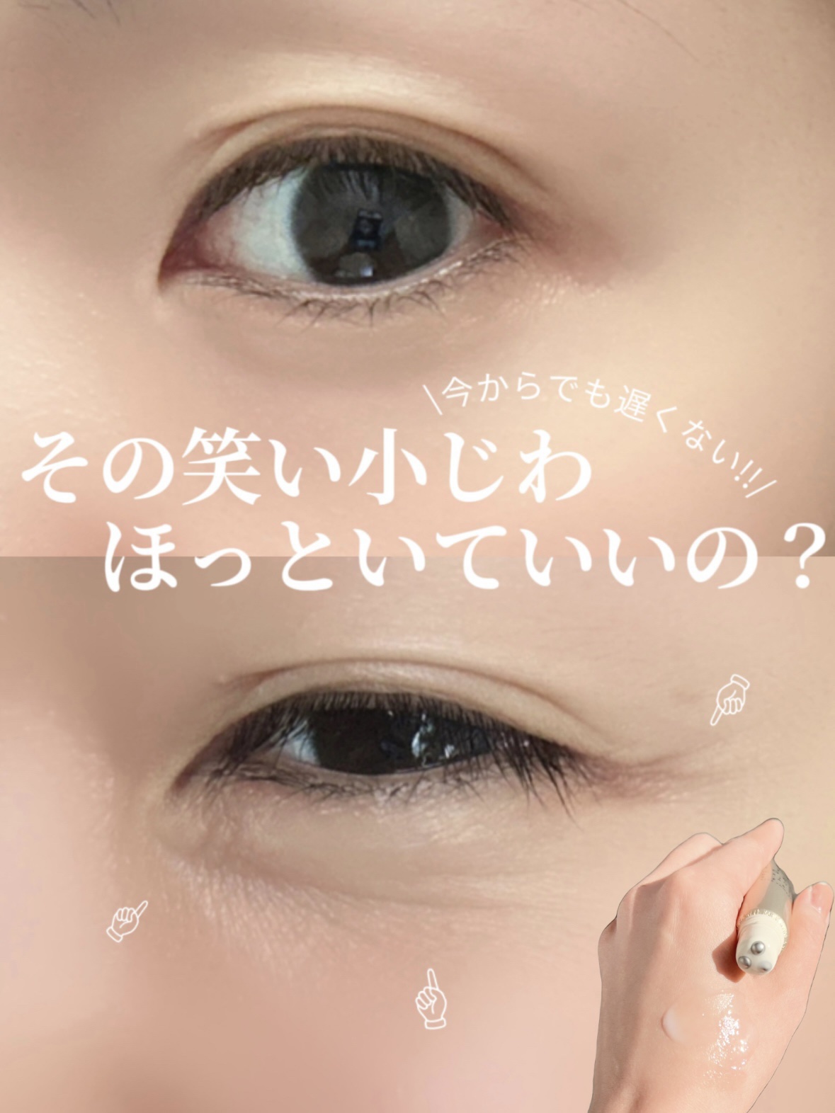 リンクルボールセラム/ライスフォース/美容液を使ったクチコミ（1枚目）