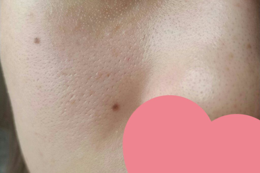 ソフティモ スーパークレンジングウォッシュ(ヒアルロン酸)/ソフティモ/洗顔フォームを使ったクチコミ(2枚目)