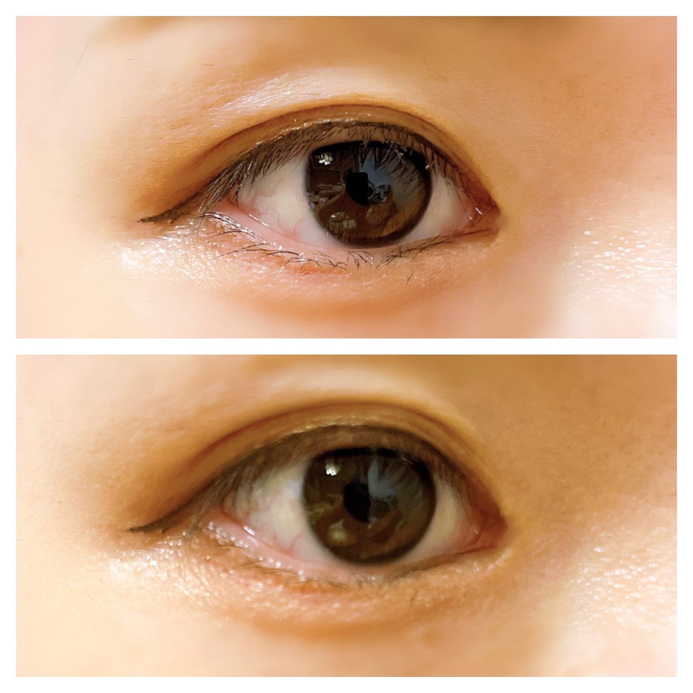 メザイク イージークリア 接着クリアタイプ/メザイク/二重まぶた用アイテムを使ったクチコミ(4枚目)