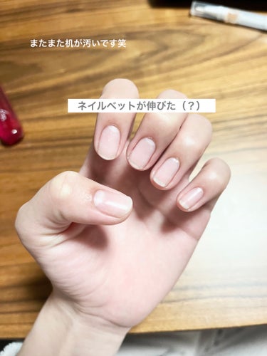 NAIL OIL/and U/ネイルオイル・トリートメントを使ったクチコミ（3枚目）