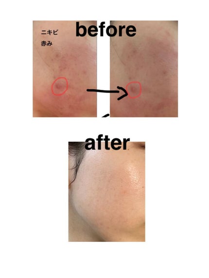 マデカソサイドリペアアンプル/VELY VELY/美容液を使ったクチコミ(2枚目)