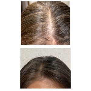 SonoRepro/アンファー(スカルプD)/ヘアケアグッズを使ったクチコミ(5枚目)