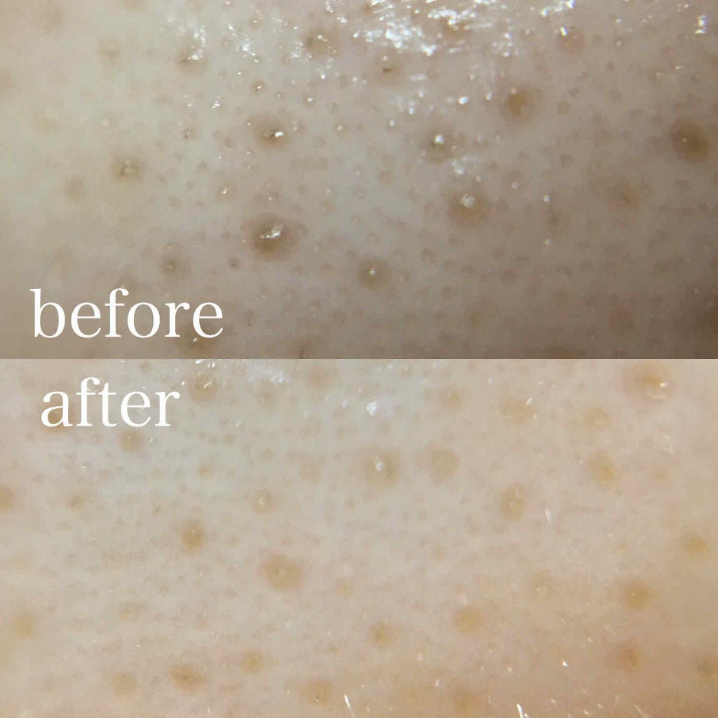 ホホバオイル/無印良品/ボディオイルを使ったクチコミ(2枚目)