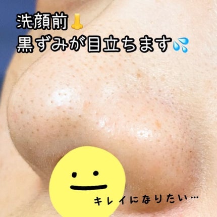 りお on LIPS 「..脱!いちご鼻🍓🥸いちご鼻で悩んでる方多いのでは??私もその..」(6枚目)