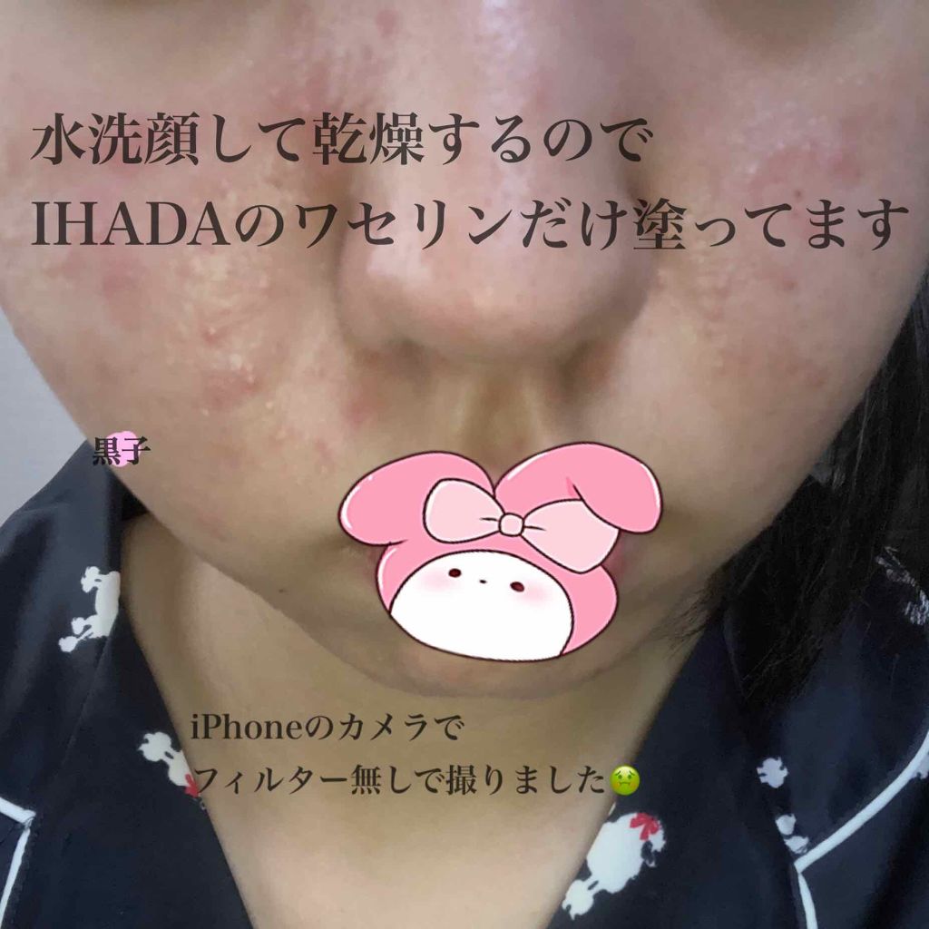 Hazuki (語彙力のない18歳) on LIPS 「Hazukiです୨୧⑅*.こんなに肌が荒れたのが初めて今日から..」(2枚目)